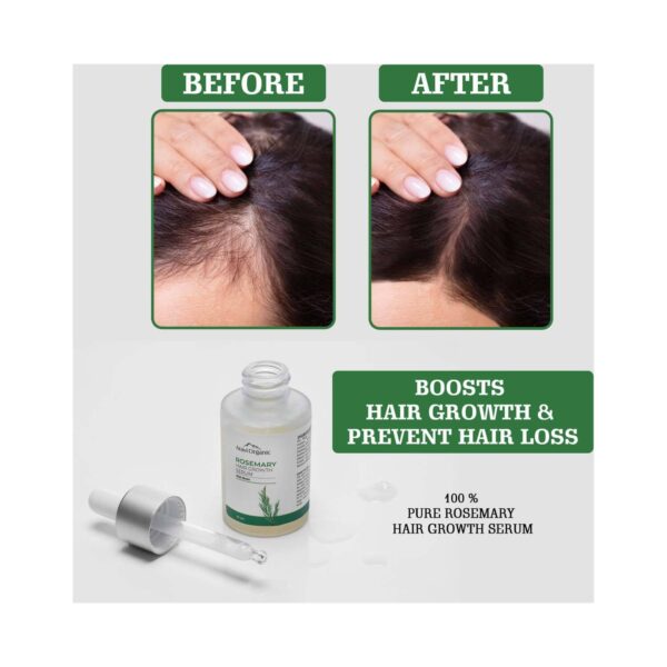 Aravi Organic Rosemary Boosts Hair Growth Serum with Biotin (30 ml) - Aravi Organic