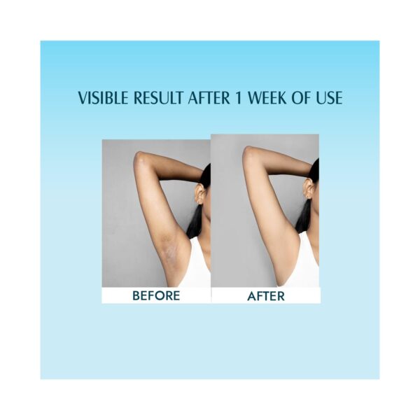 Aravi Organic Under Arm Roll On - 5% AHA 2% Kojic Acid & 1% Mandelic Acid Control Body Odour (50 ml) - Aravi Organic