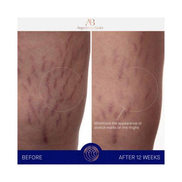 Augustinus Bader The Body Cream (200 ml) - Augustinus Bader