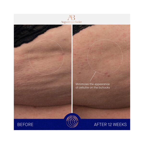 Augustinus Bader The Body Cream (200 ml) - Augustinus Bader