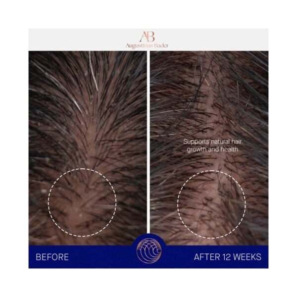 Augustinus Bader The Conditioner (150 ml) - Augustinus Bader