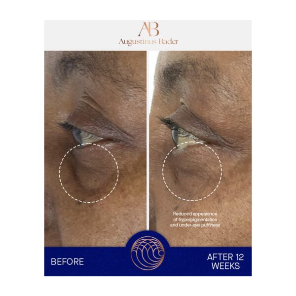 Augustinus Bader The Eye Cream (15 ml) - Augustinus Bader