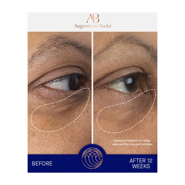 Augustinus Bader The Eye Cream (15 ml) - Augustinus Bader