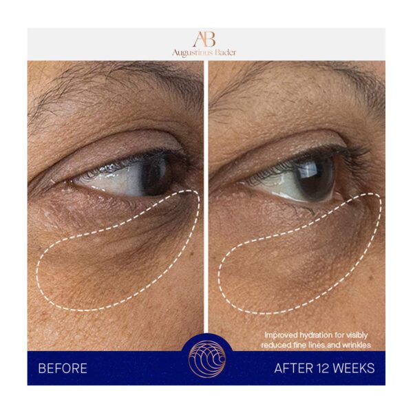 Augustinus Bader The Eye Cream Nomad (15 ml) - Augustinus Bader