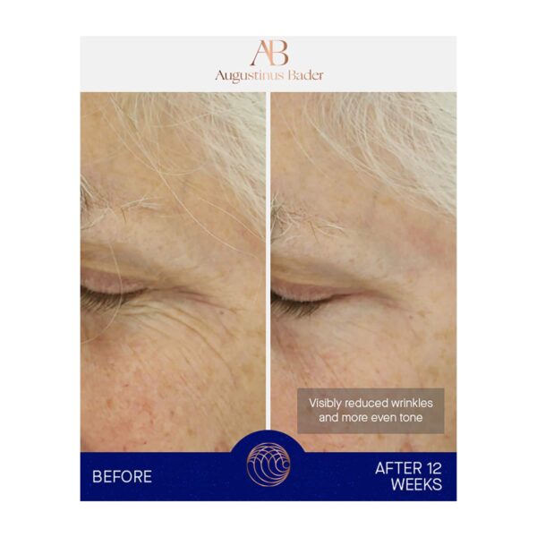 Augustinus Bader The Light Cream (30 ml) - Augustinus Bader