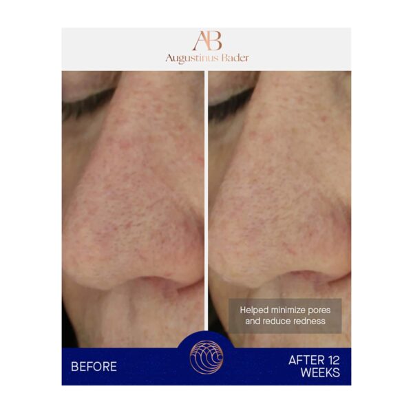 Augustinus Bader The Light Cream (30 ml) - Augustinus Bader