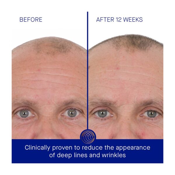 Augustinus Bader The Retinol Serum (50 ml) - Augustinus Bader