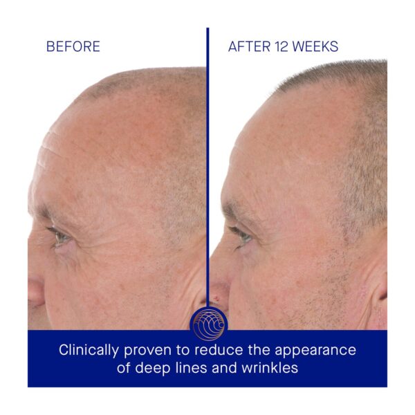 Augustinus Bader The Retinol Serum (50 ml) - Augustinus Bader