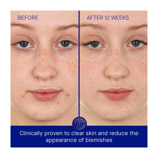 Augustinus Bader The Retinol Serum (50 ml) - Augustinus Bader