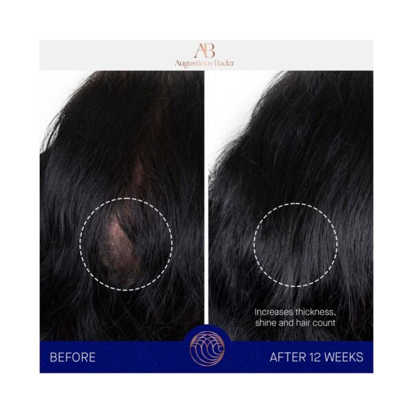 Augustinus Bader The Scalp Treatment (30 ml) - Augustinus Bader