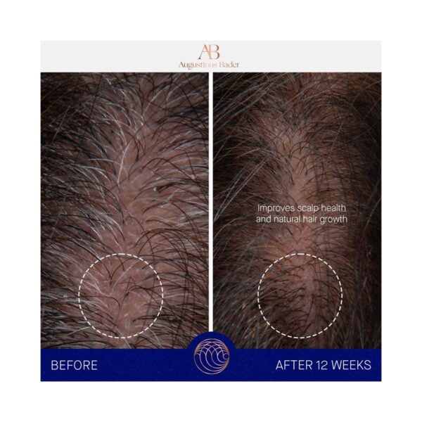Augustinus Bader The Scalp Treatment (30 ml) - Augustinus Bader