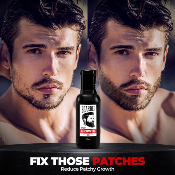 Beardo Beard & Hair Growth Oil (30 ml) - Beardo