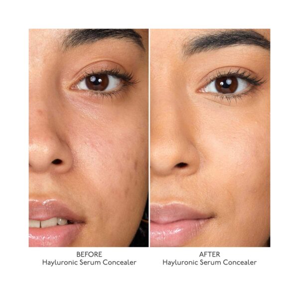 By Terry Hyaluronic Serum Concealer - 4. Rosy Nude (5.2 ml) - By Terry