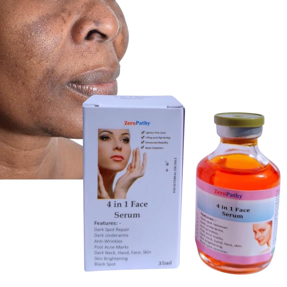 Dark Spot Corrector Cream 35ML | With Aloe vera extracts Helps Reducing Dark Acne Marks | For A Refreshed and Brighter Skin Face Serum Vitamin C Cream For Women Glowing Skin (35ml)
