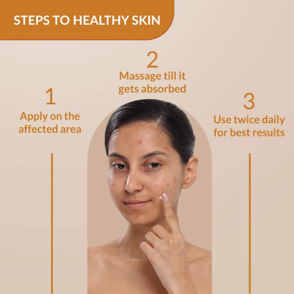 Fixderma 2% Kojic Acid + 1% Arbutin Skarfix-Plus Scar Removal Cream (30 g) - Fixderma