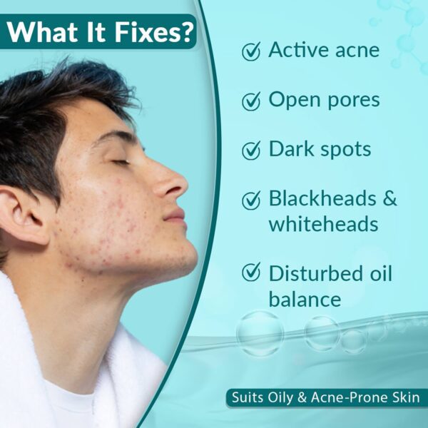Fixderma 2% Salicylic Acid with 5% Azelaic Acid & 4% Mandelic Acid & Anti Acne Face Serum (15g) - Fixderma