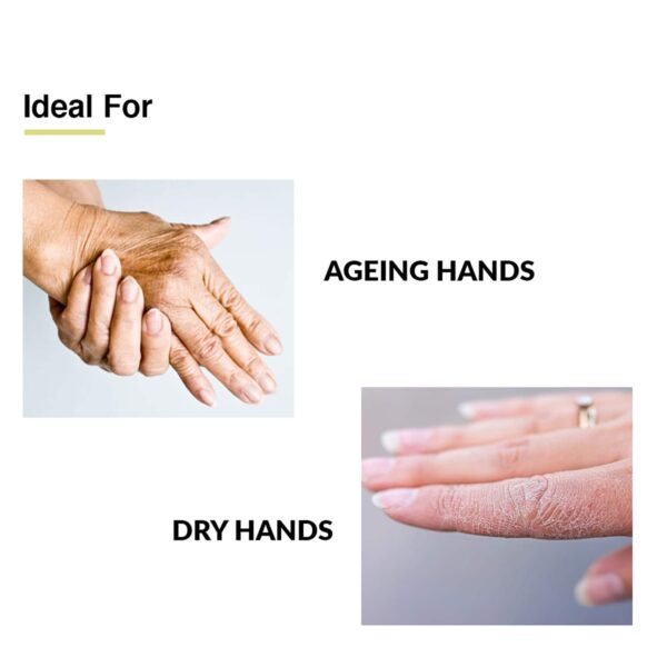 Fixderma Anti Aging Hand Cream for Dry And Rough Hands All Skins Types (30 g) - Fixderma