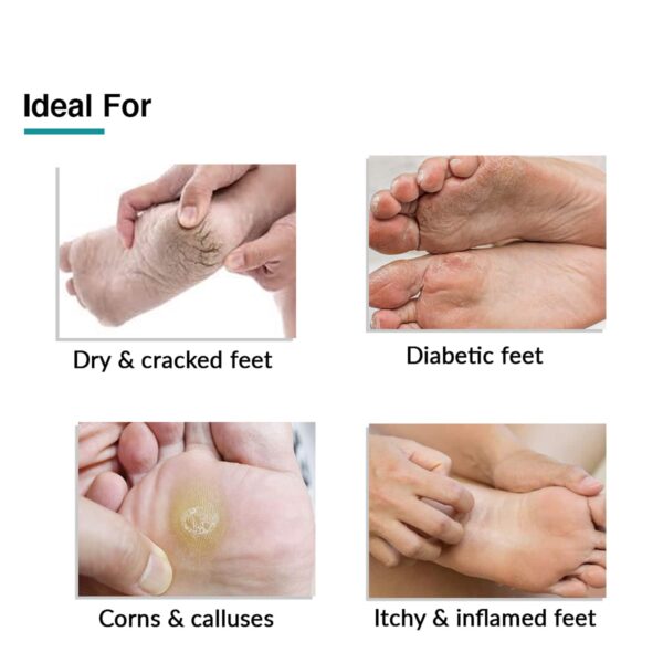 Fixderma Foobetik Heel Repair Foot Cream for Calloused or Chapped Skin (50 g) - Fixderma
