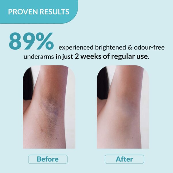 Fixderma Nigrifix Underarm Ocean Roll on - Brightens Skin & Exfoliates Underarm (60 ml) - Fixderma