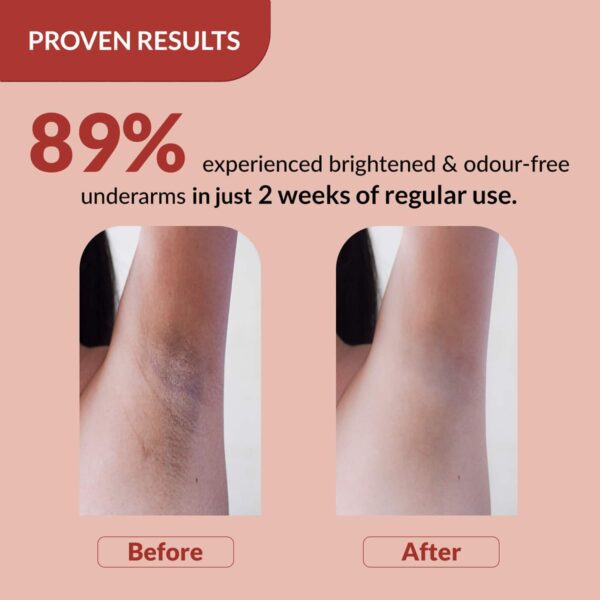 Fixderma Nigrifix Underarm Velvet Musk Roll on Brightens Skin & Exfoliates Underarm (60 ml) - Fixderma