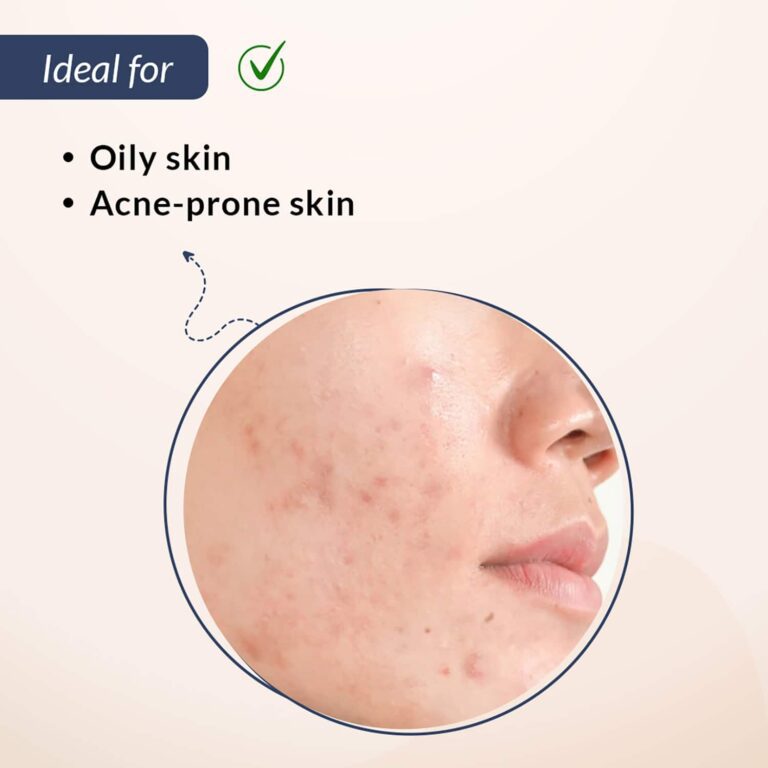 Fixderma Salyzap Acne Kit (4Pcs) - Fixderma