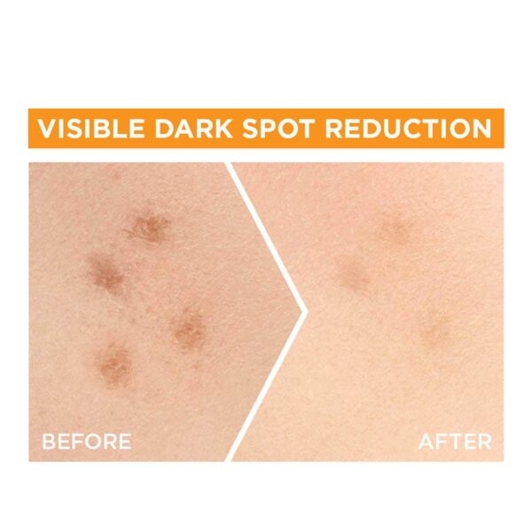 Garnier Bright Complete Vitamin C Booster Serum (15 ml) - Garnier