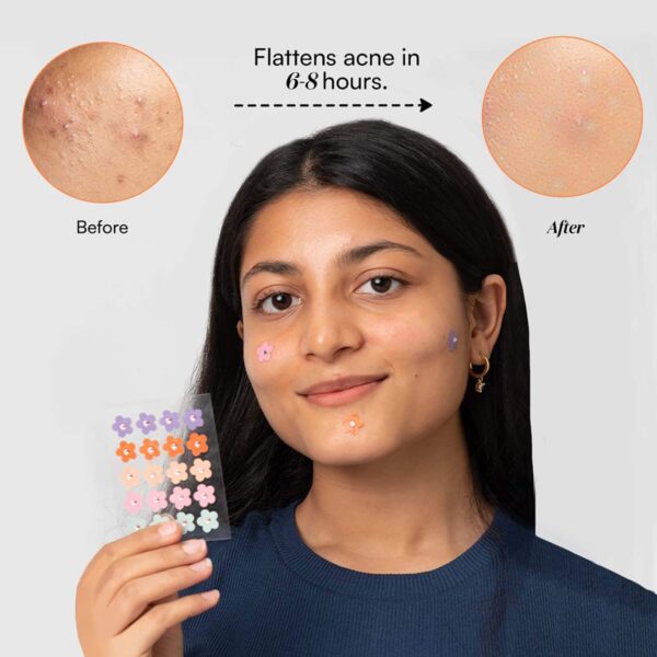 Gush Beauty Dart It Hydrocolloid Pimple Patches for Healing Acne, Zits and Blemishes - Holographic Butterfly - Gush Beauty
