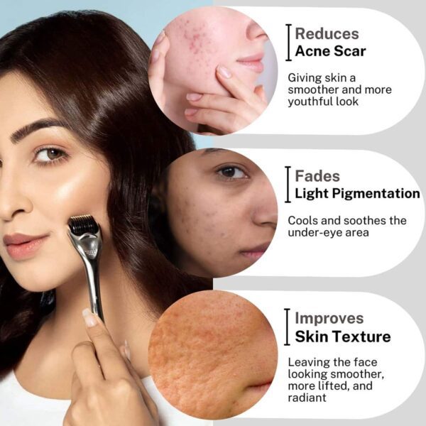 House of Beauty Derma Roller 0.50mm Reduces Pigmentation, Fade Pimples & Acne Scars (1 Pc) - House of Beauty