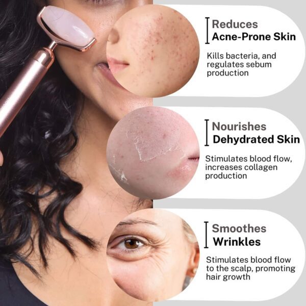 House of Beauty Rose Quartz Dermaroller - House of Beauty
