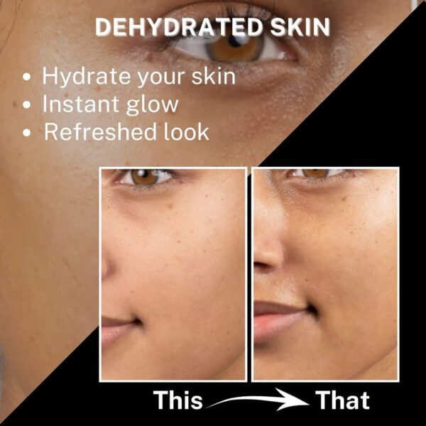 House of Beauty Tea Tree+Avocado Toner-Oily, Combination & Sensitive & Acne Prone Skin (100 ml) - House of Beauty