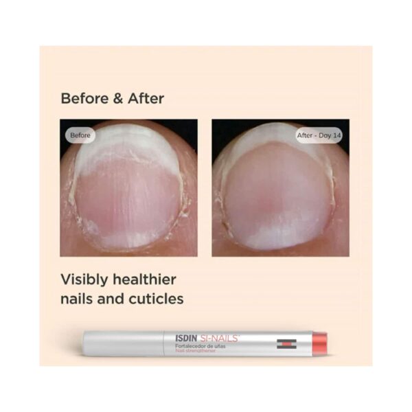 ISDIN Si-Nails Nail Strengthening Treatment (2.5 ml) - ISDIN