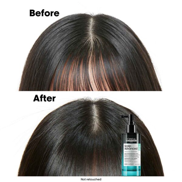 L'OREAL PROFESSIONNEL Scalp Advanced 5-in-1 Professional Leave-in Serum for Scalp Care (90 ml) - L'OREAL PROFESSIONNEL