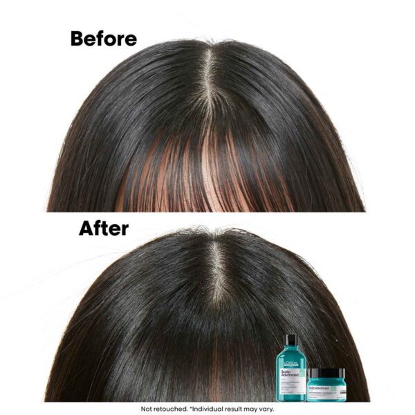 L'OREAL PROFESSIONNEL Scalp Advanced Anti-Oiliness 2-In-1 Deep Purifier Clay (250 ml) - L'OREAL PROFESSIONNEL