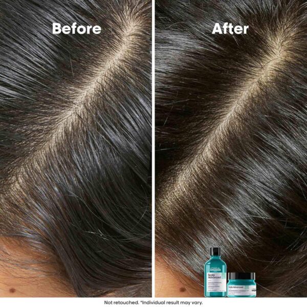 L'OREAL PROFESSIONNEL Scalp Anti-Oiliness Shampoo (300 ml), 2-In-1 Deep Purifier Clay (250 g) Combo - L'OREAL PROFESSIONNEL