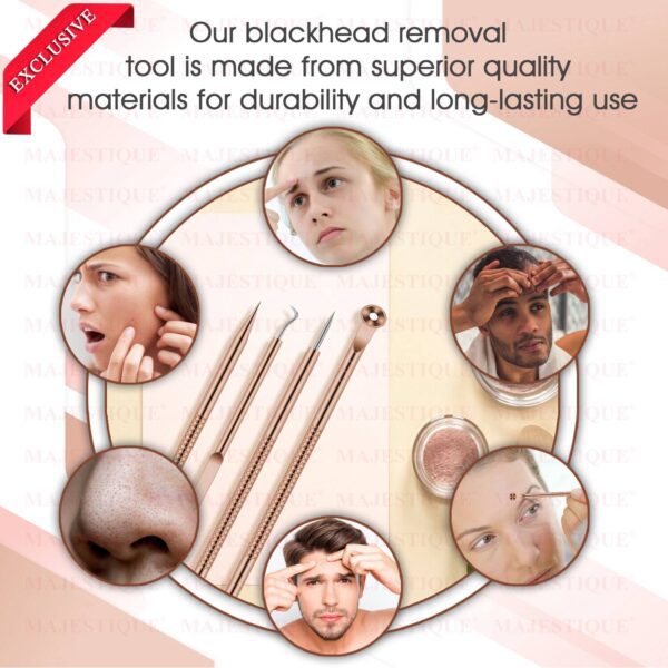 Majestique Blackhead Remover kit 4Pcs, Blackhead Extractor Tool for Nose Face - Majestique