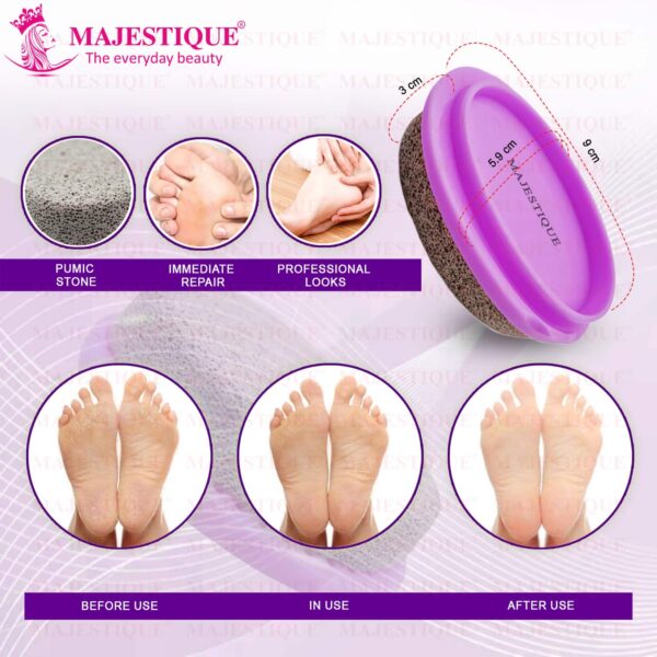Majestique Easy Grip Pumice Stone for Hands, Heels, Elbows - Color May Vary - Majestique
