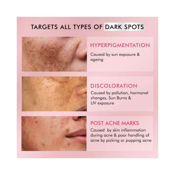 mCaffeine 2% Kojic Acid & 1% Niacinamide De-Pigmentation Cream (50 ml) - mCaffeine