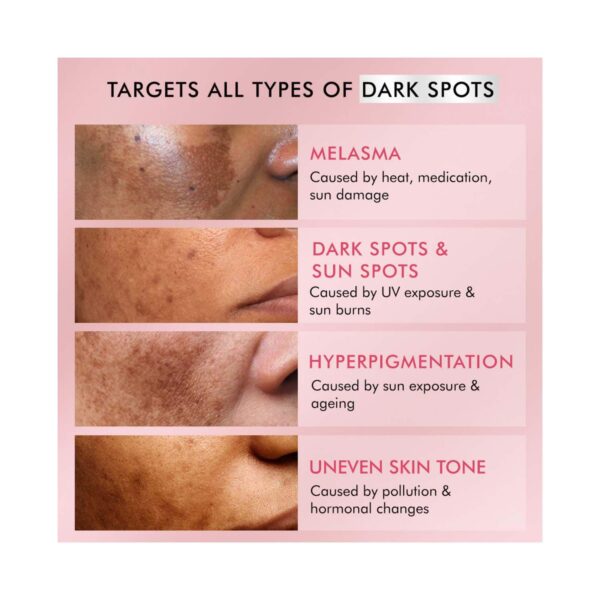 mCaffeine Clear Glow 3% Tranexamic 2% Alpha Arbutin Advanced Pigmentation Serum Treatment (20 ml) - mCaffeine