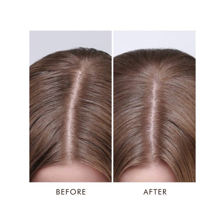 Moroccanoil Dry Scalp Hair Treatment (45ml) - Moroccanoil