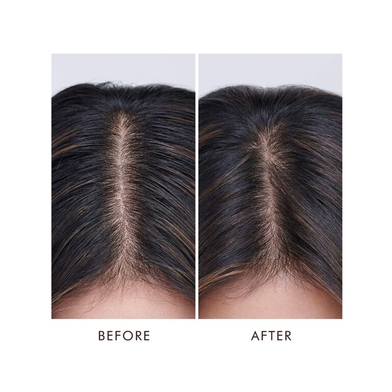 Moroccanoil Oily Scalp Hair Treatment (45ml) - Moroccanoil