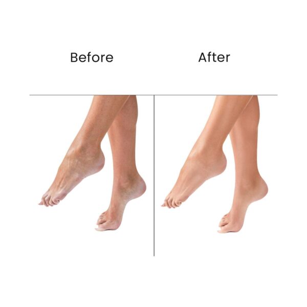 O3+ Pedilogix Scoop Bomb Pedicure With Bath Bomb For Soft and Moisturised Feet (110 g) - O3+