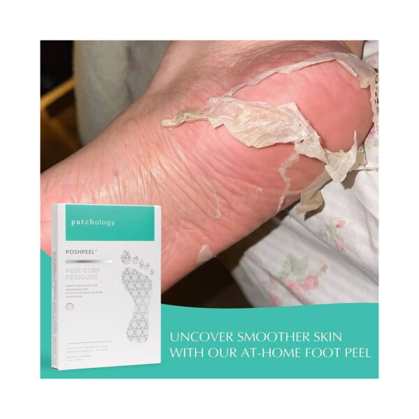 Patchology Poshpeel Pedi Cure Treatment - Patchology