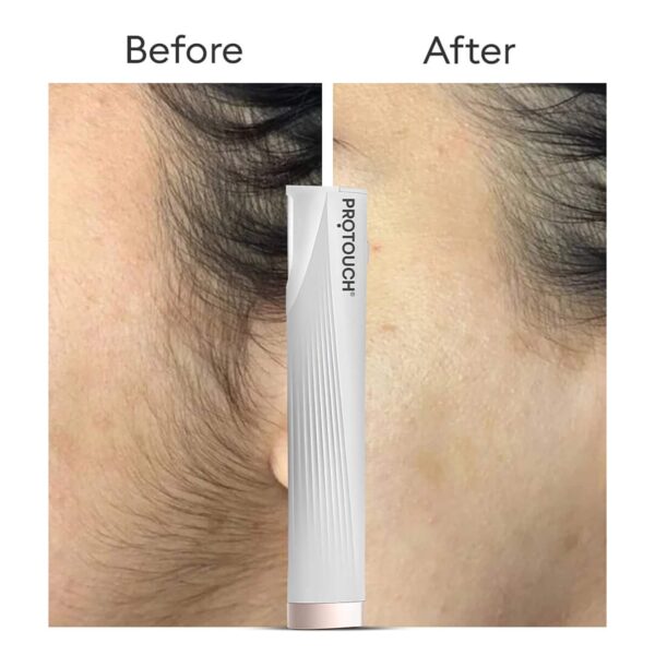 Protouch Dermaplaning Device Electric 2 in 1 Eyebrow and Face Hair Remover (250 g) - Protouch