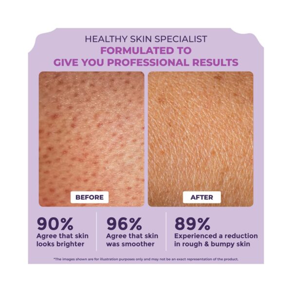 Sanfe Clear & Confident Glycolic Acid And Daily AHA Lotion For Smooths Rough & Bumpy Skin (200ml) - Sanfe