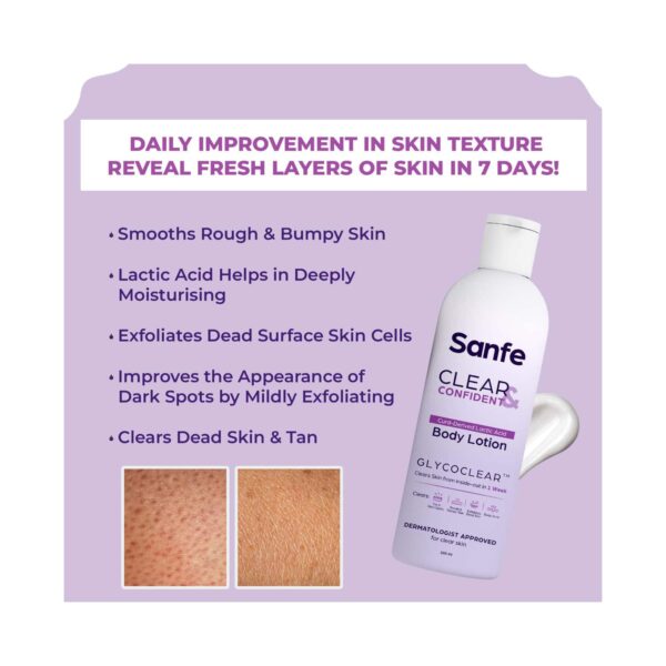 Sanfe Clear & Confident Glycolic Acid And Daily AHA Lotion For Smooths Rough & Bumpy Skin (200ml) - Sanfe