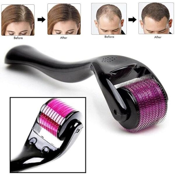 Shopfer Derma Roller 1.00 mm & 1.5 mm | 540 Titanium Alloy Needles | Enhances Beard & Hair Growth | Reduces Acne Scars | Safe & Effective for Skin & Scalp (1.00 mm)