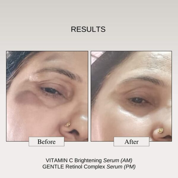 The Formularx Vitamin C Brightening Serum With Vitamin C 10%, Arbutin 2% & N-Acetylglucosamine 2% (30g) - The Formularx