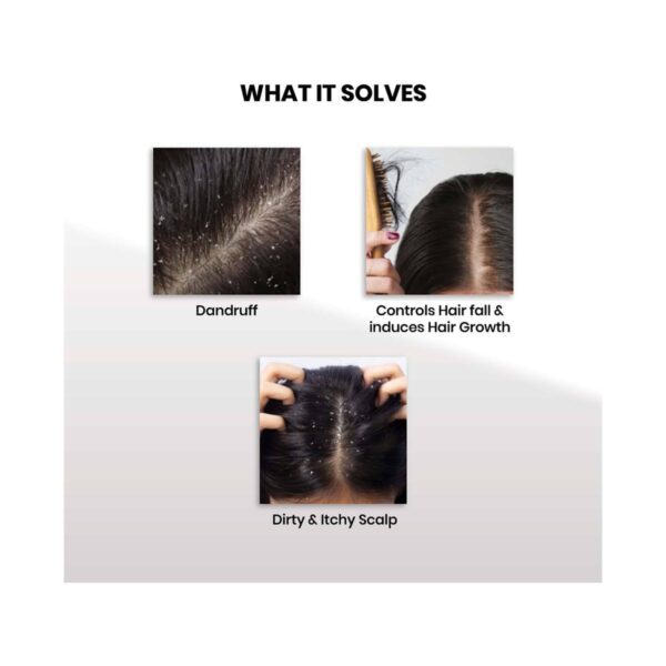 ThriveCo Triple Action Hair Health Kit With Scalp Serum, Scrub & Hair Serum 2.0 Roll On (3 pcs) - Thriveco