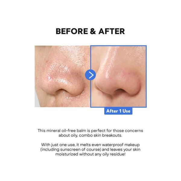 TIRTIR Hydro Boost Enzyme Cleansing Balm (50 ml) - TIRTIR