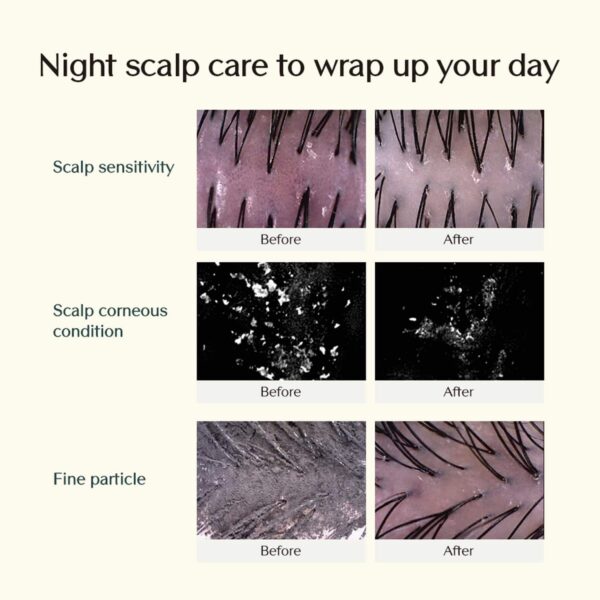 Treecell Day and Night Shampoo Combo - Treecell